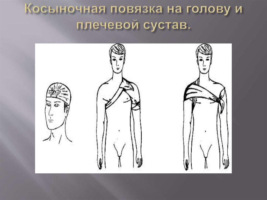 Косыночная повязка на голову и плечевой сустав.