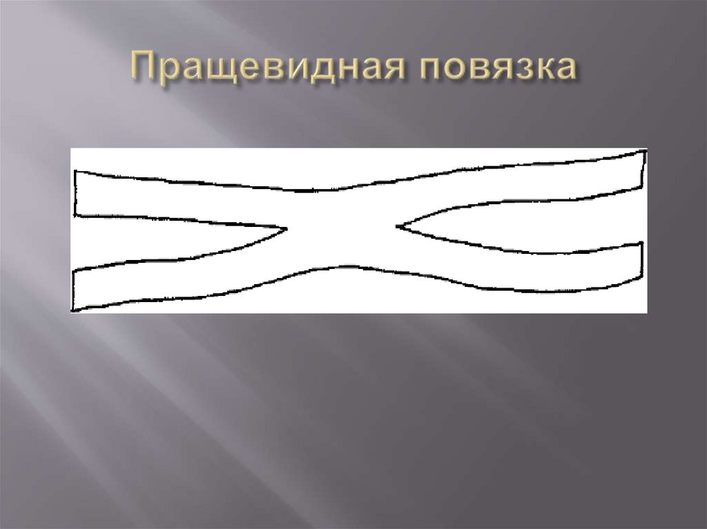 Пращевидная повязка