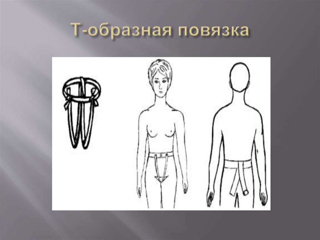 Т-образная повязка