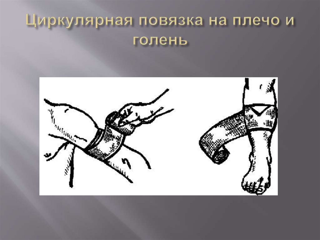 Циркулярная повязка на плечо и голень