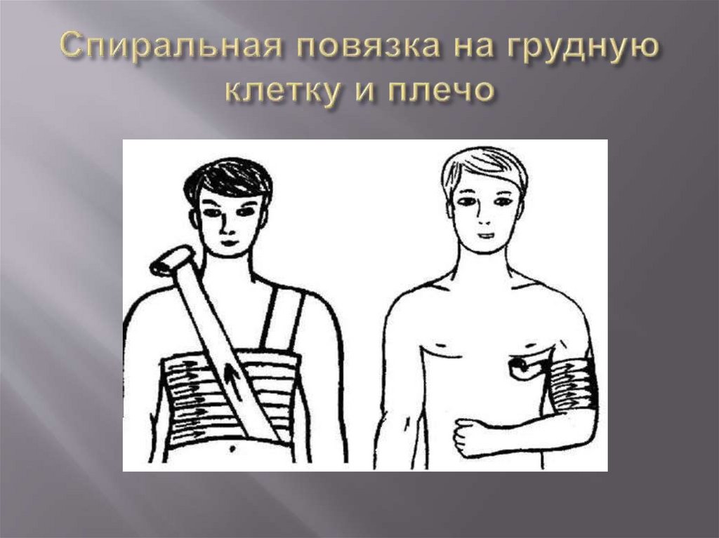 Спиральная повязка на грудную клетку и плечо