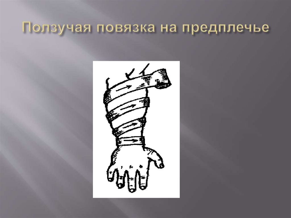Ползучая повязка на предплечье