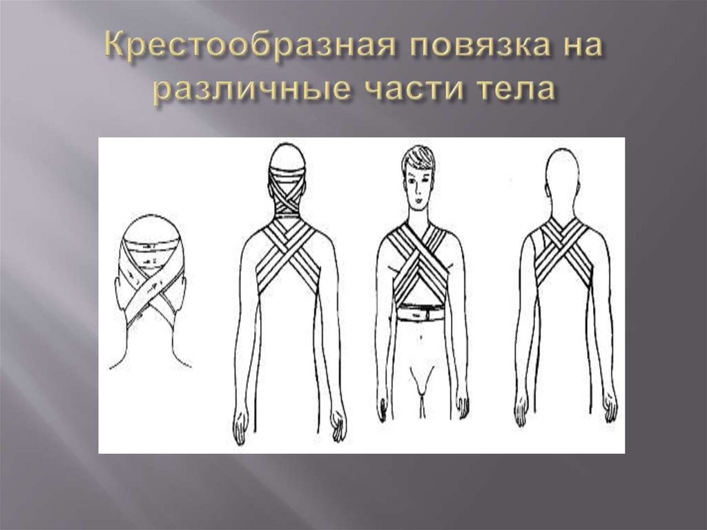 Крестообразная повязка на различные части тела