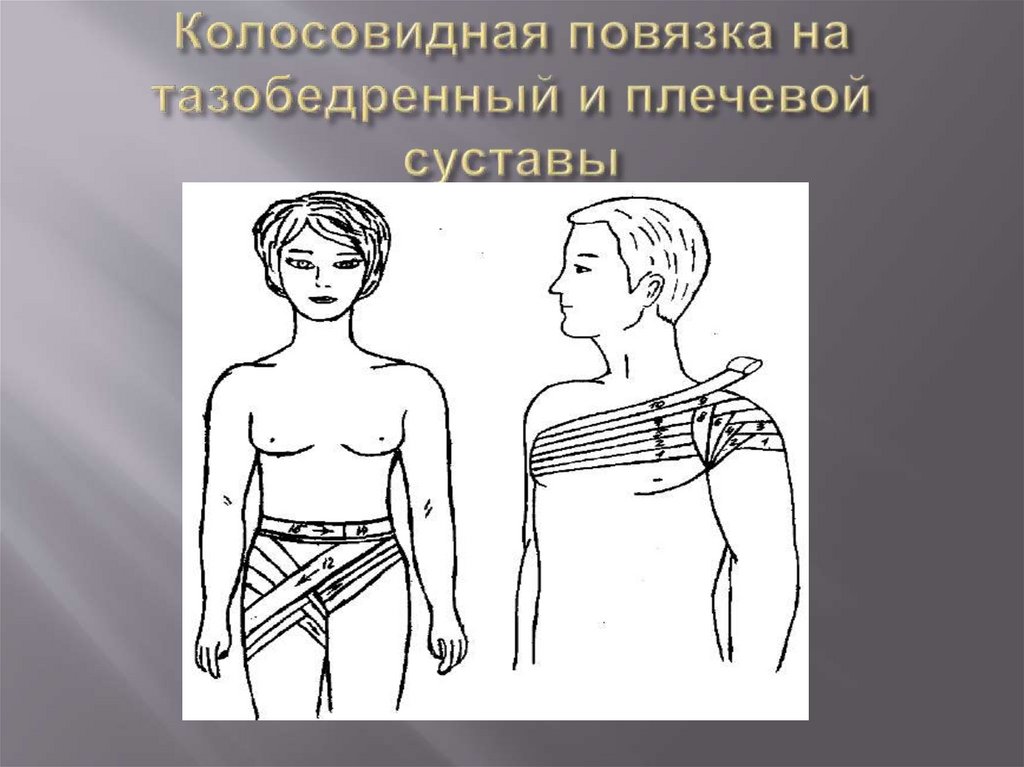 Колосовидная повязка на тазобедренный и плечевой суставы