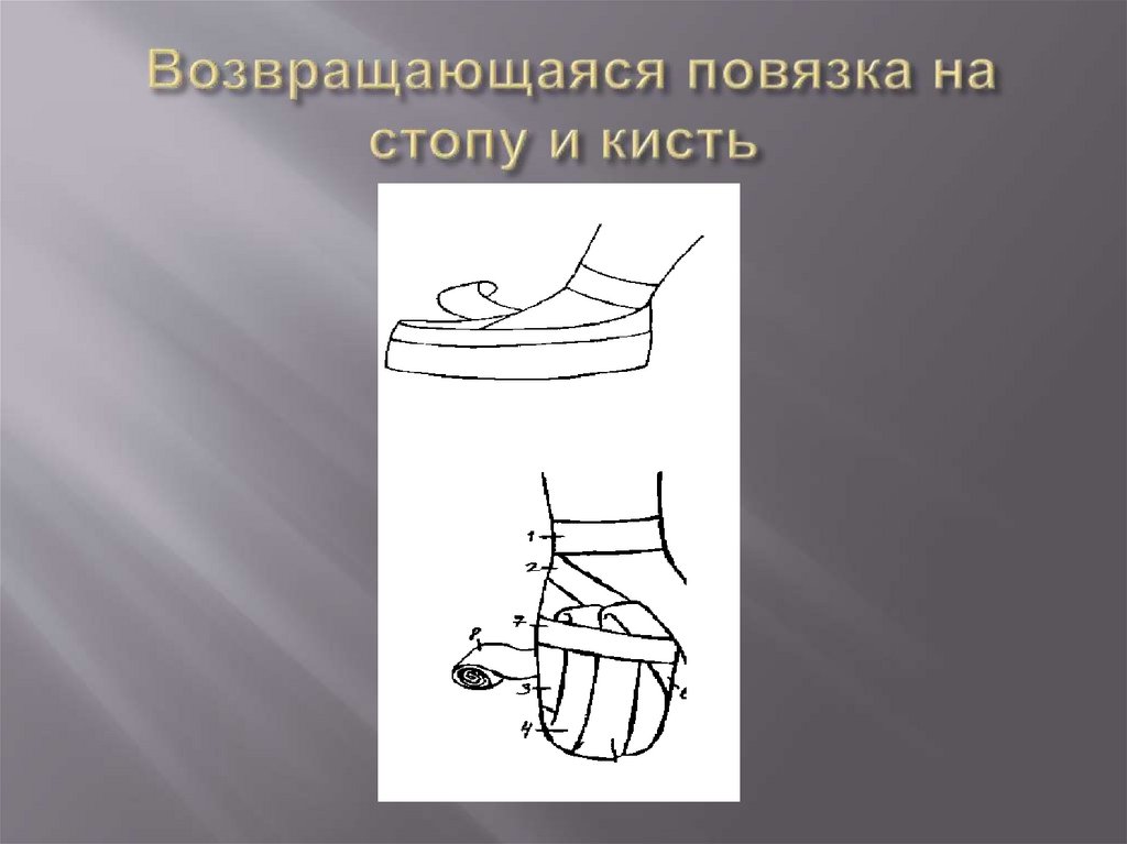 Возвращающаяся повязка на стопу и кисть