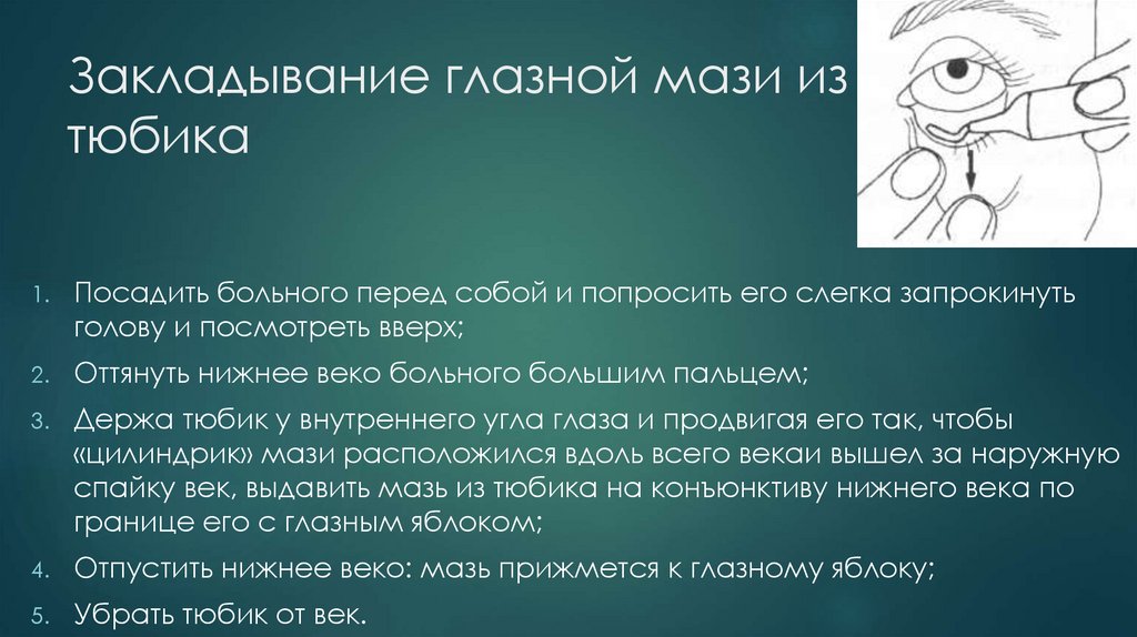 Закладывание глазной мази из тюбика