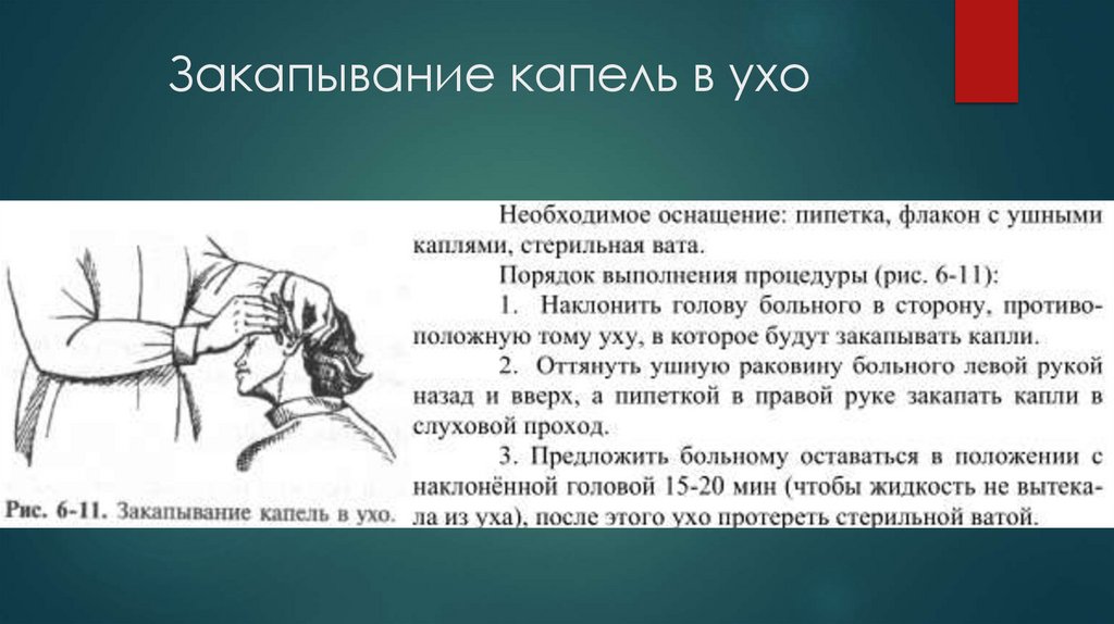 Закапывание капель в ухо