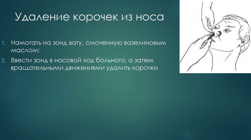 Удаление корочек из носа