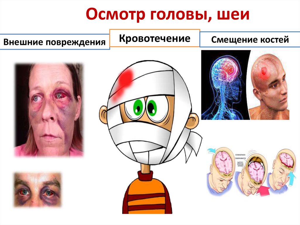 Осмотр головы, шеи