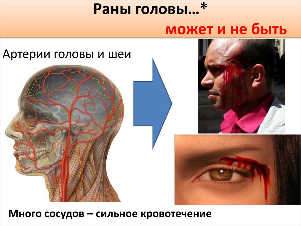 Раны головы…* может и не быть
