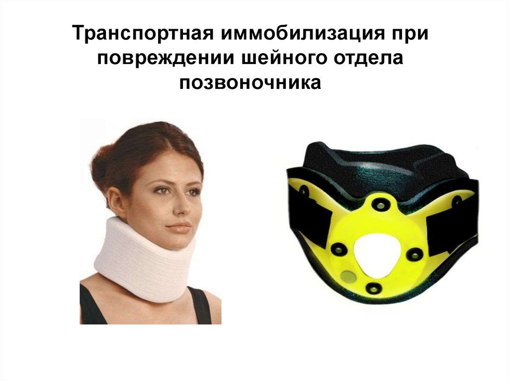 Транспортная иммобилизация при повреждении шейного отдела позвоночника