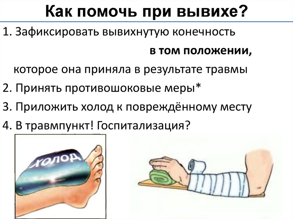 Как помочь при вывихе?