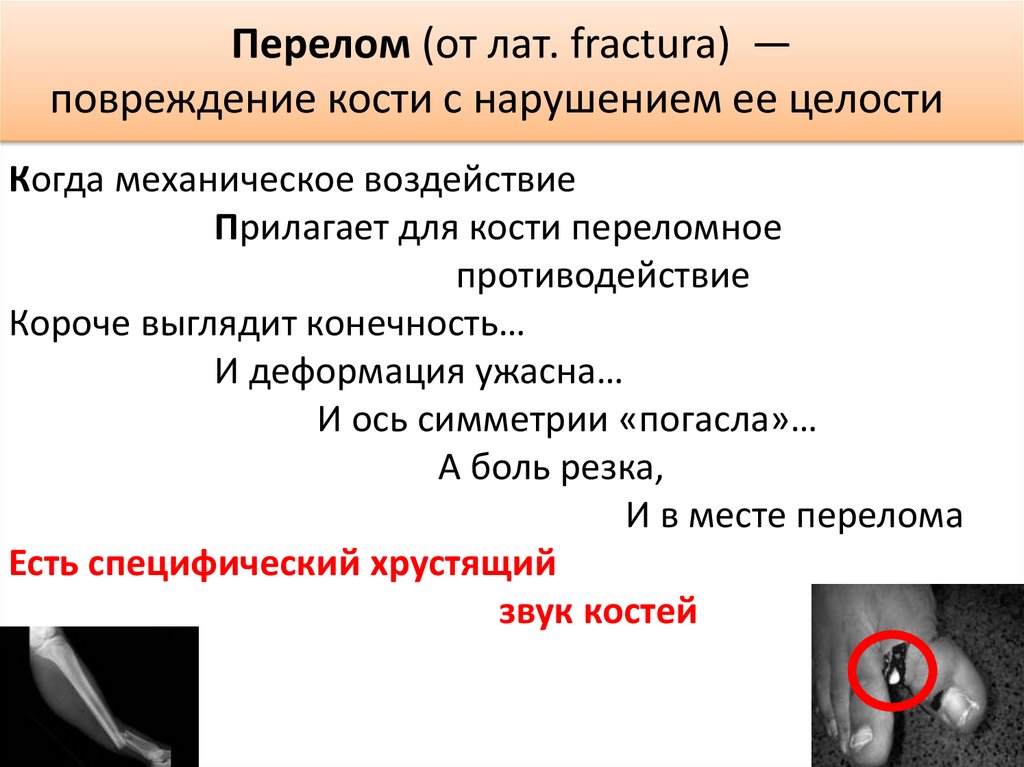 Перелом (от лат. fractura)  — повреждение кости с нарушением ее целости