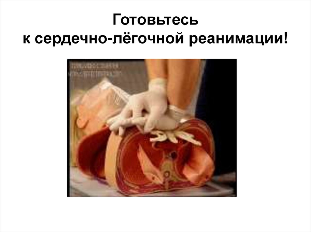 Готовьтесь к сердечно-лёгочной реанимации!