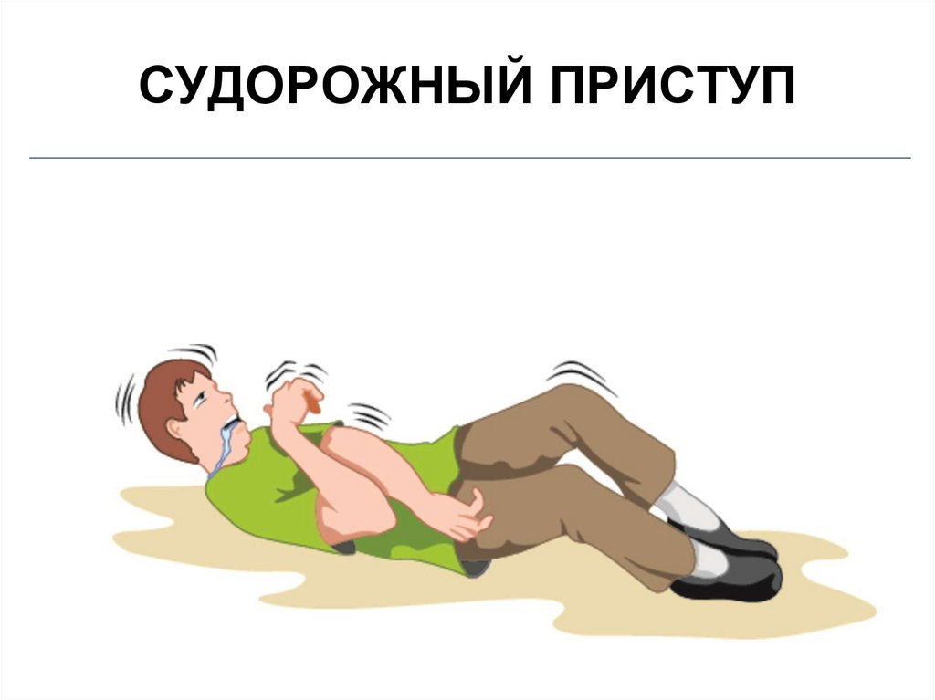 СУДОРОЖНЫЙ ПРИСТУП