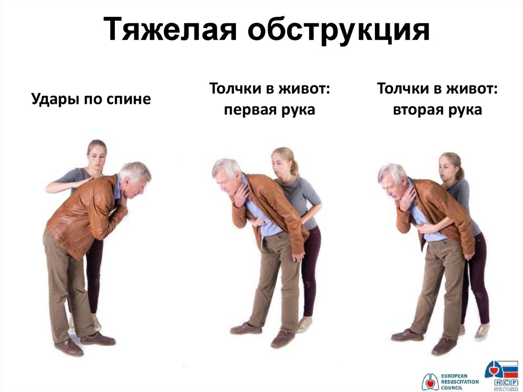 Тяжелая обструкция