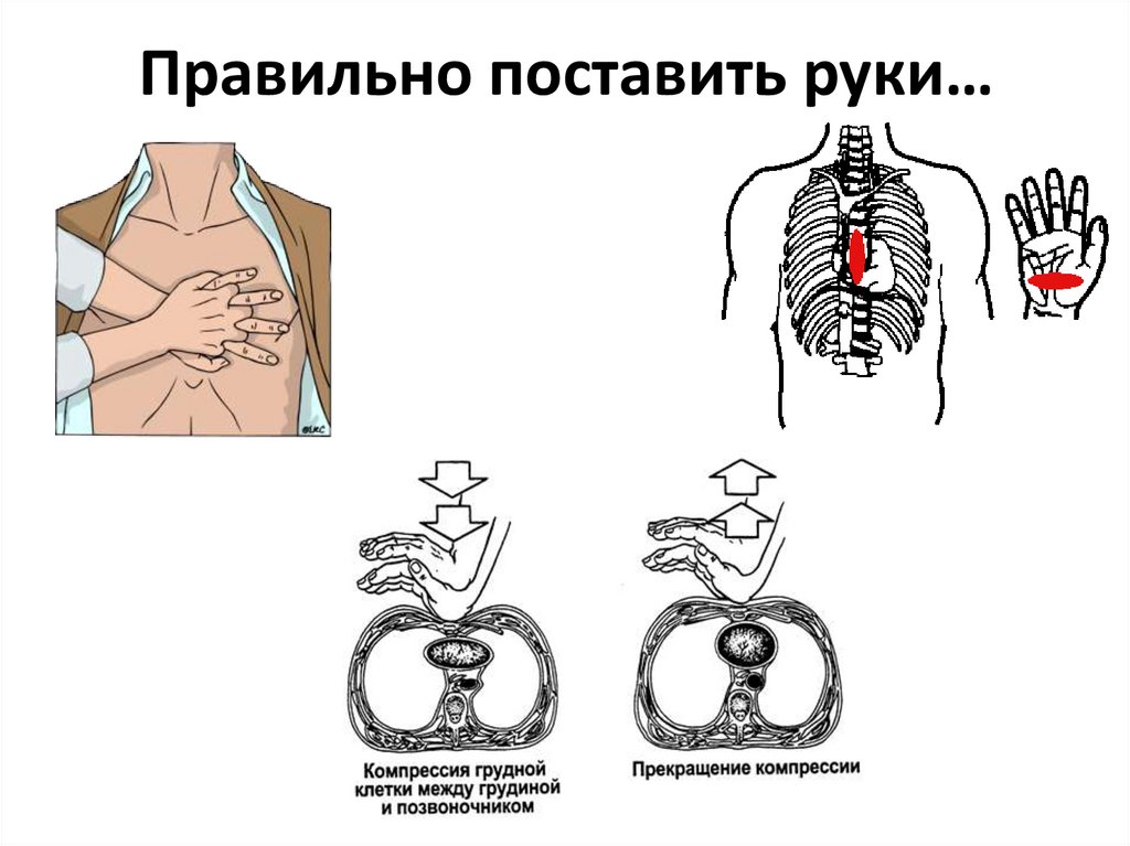 Правильно поставить руки…