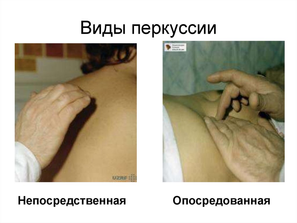 Виды перкуссии