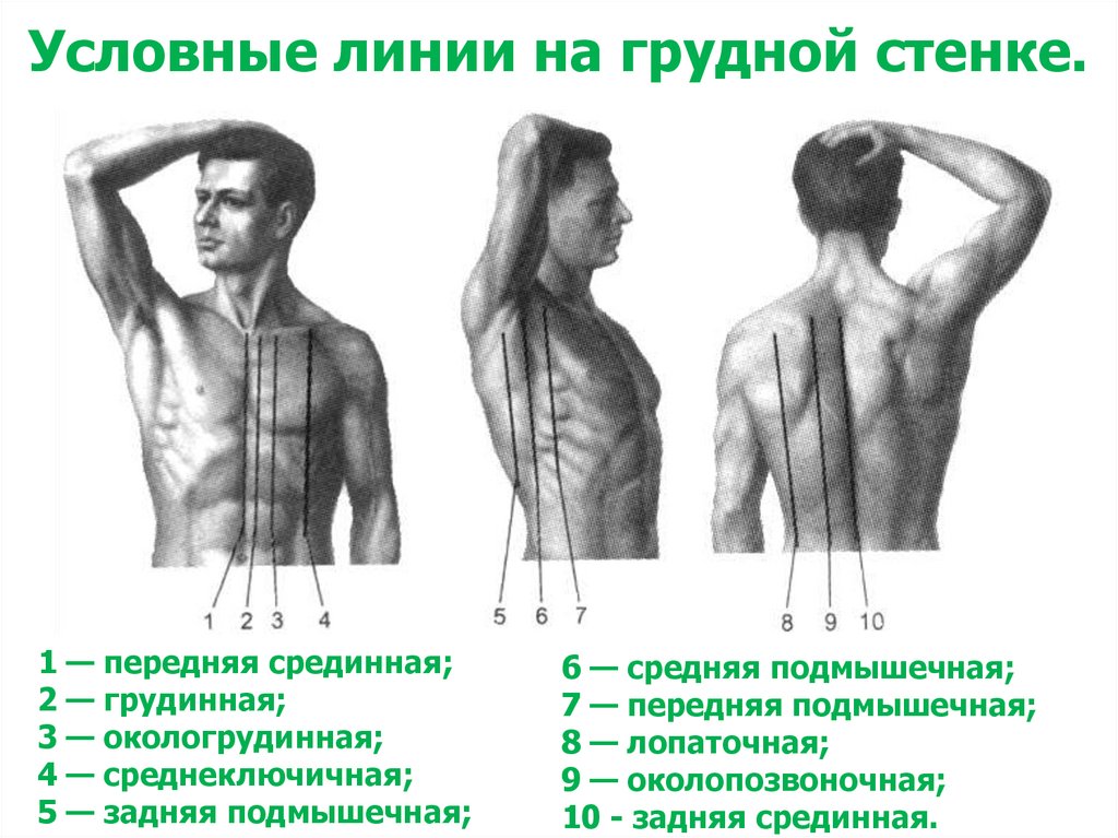 Условные линии на грудной стенке.