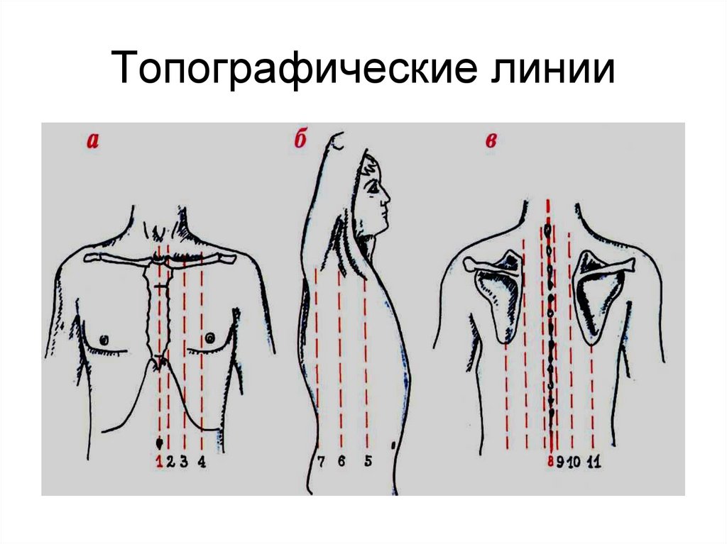 Топографические линии