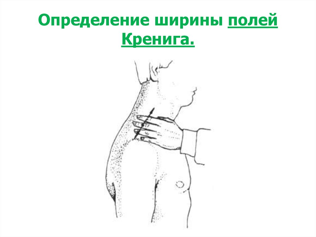 Определение ширины полей Кренига.