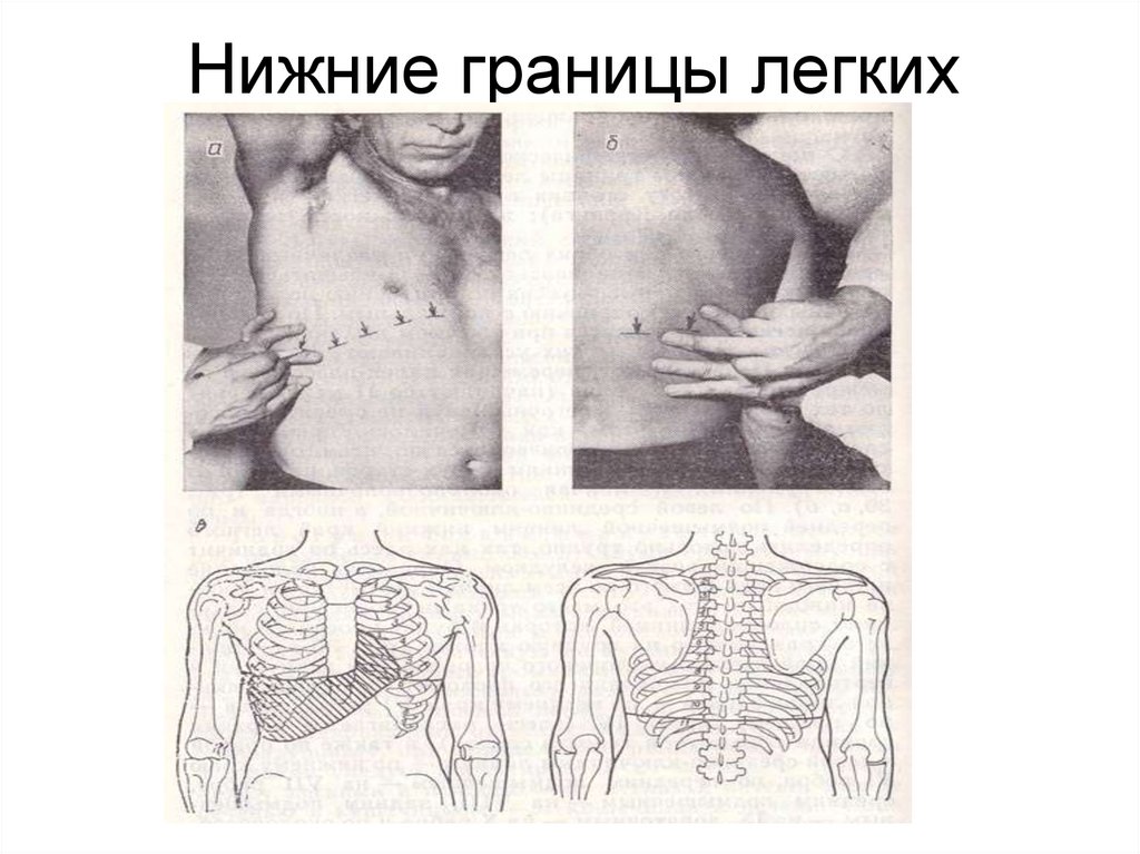 Нижние границы легких