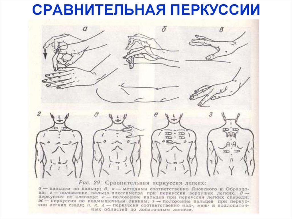 СРАВНИТЕЛЬНАЯ ПЕРКУССИИ