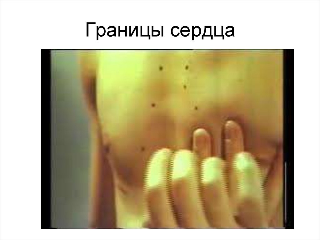 Границы сердца