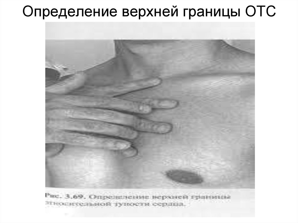 Определение верхней границы ОТС