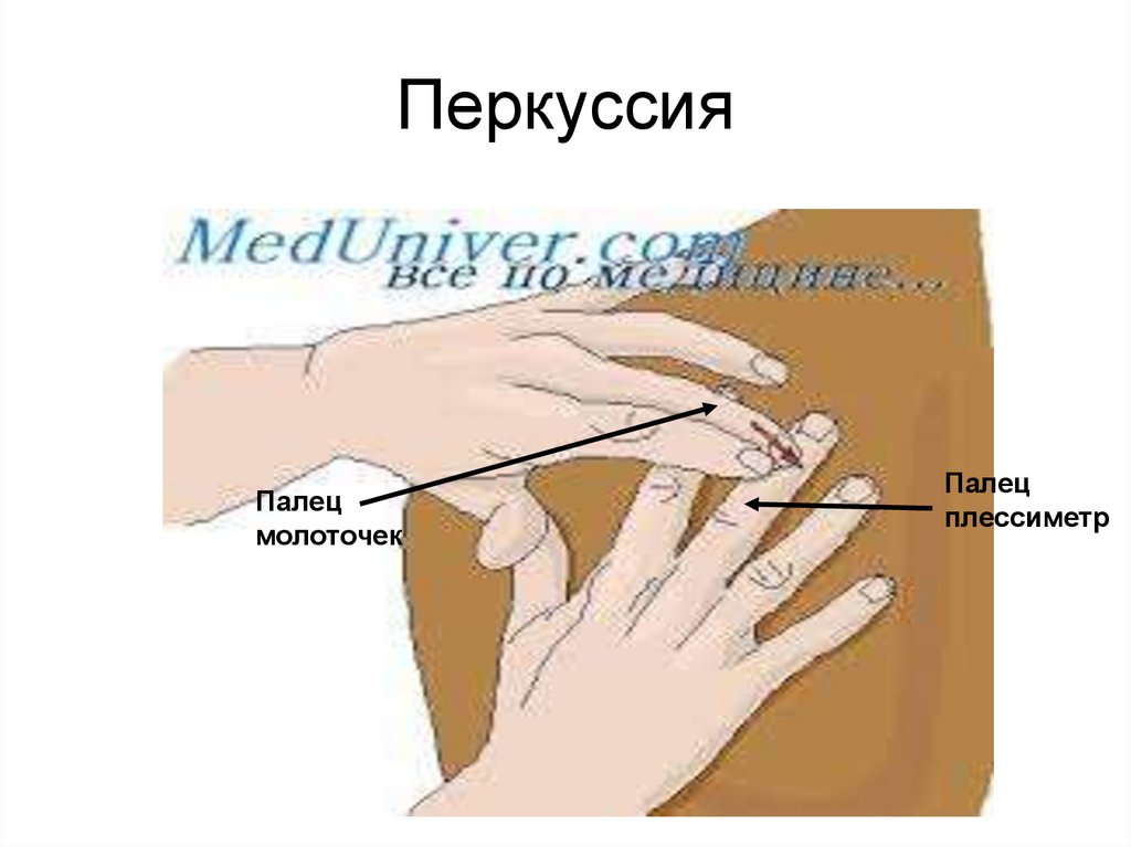Перкуссия