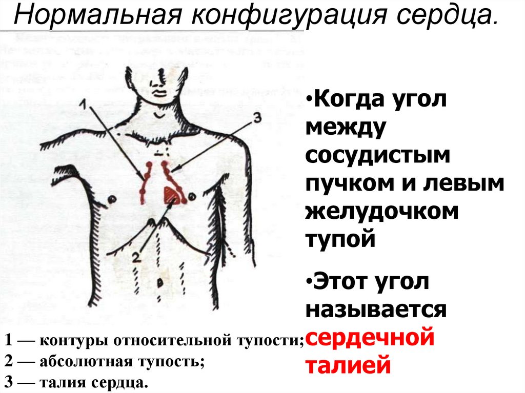 Нормальная конфигурация сердца.