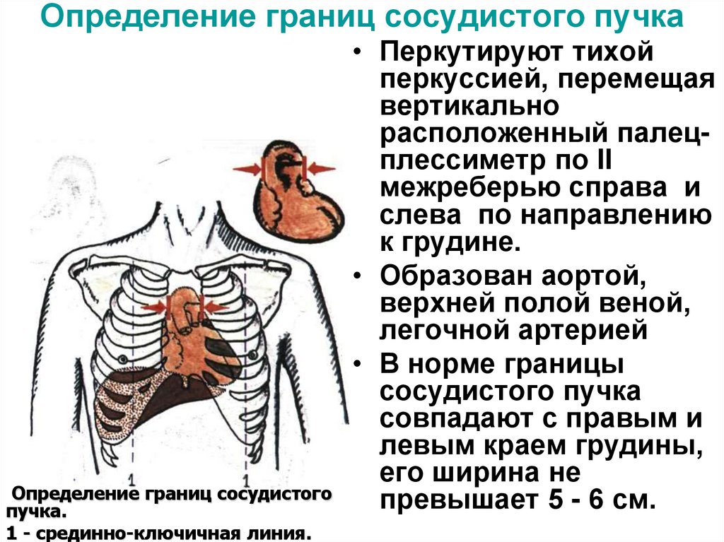 Определение границ сосудистого пучка