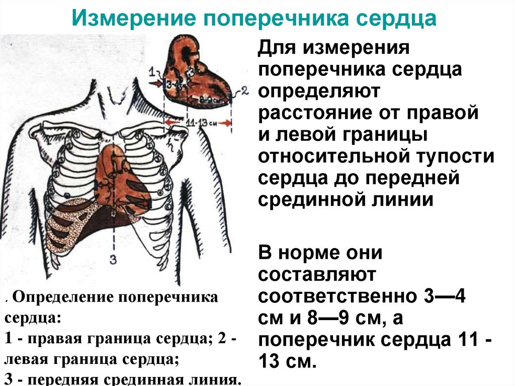 Измерение поперечника сердца