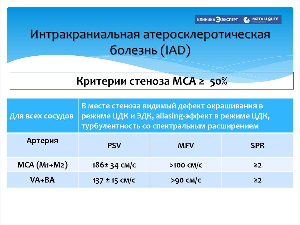 Интракраниальная атеросклеротическая болезнь (IAD)