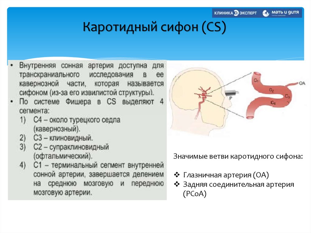 Каротидный сифон (CS)