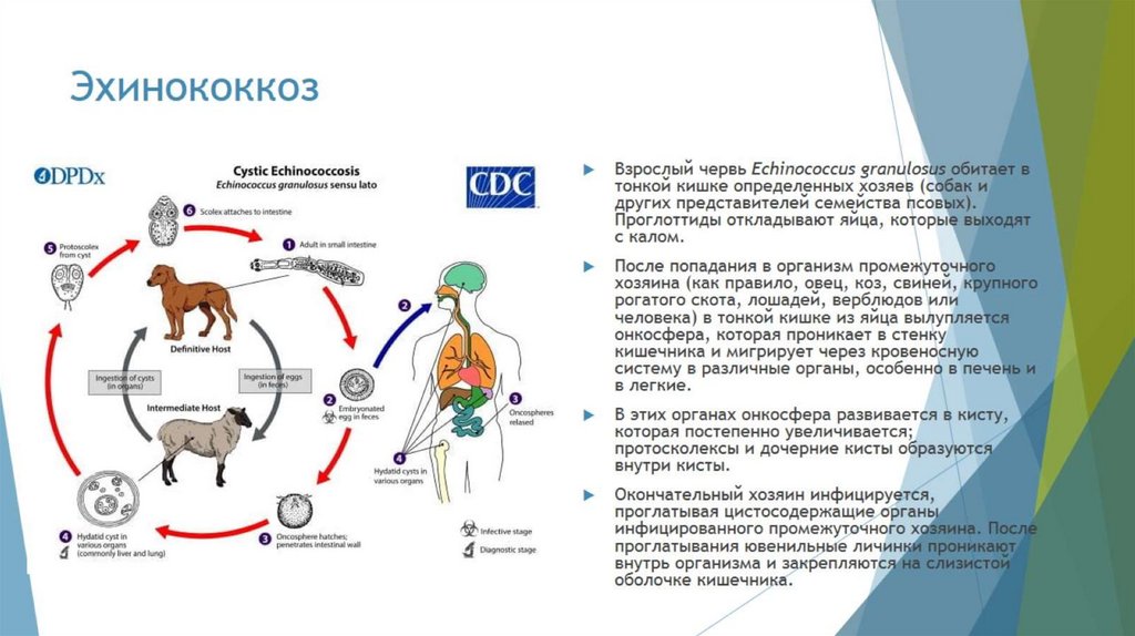 Эхинококкоз