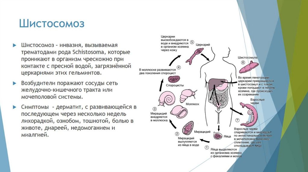 Шистосомоз