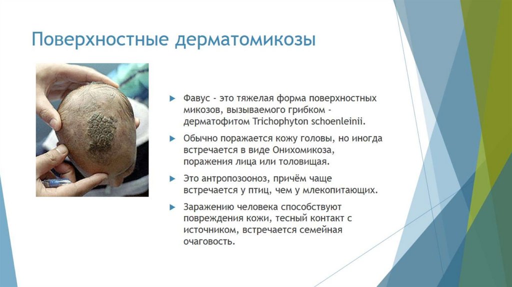 Поверхностные дерматомикозы