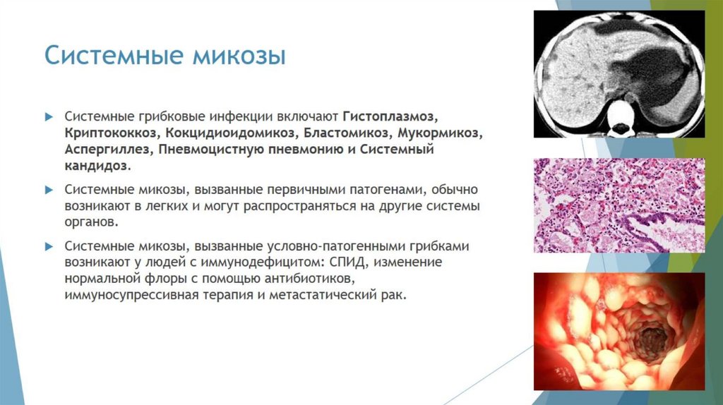 Системные микозы