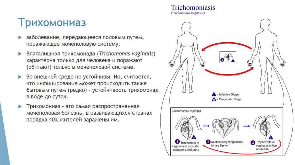 Трихомониаз