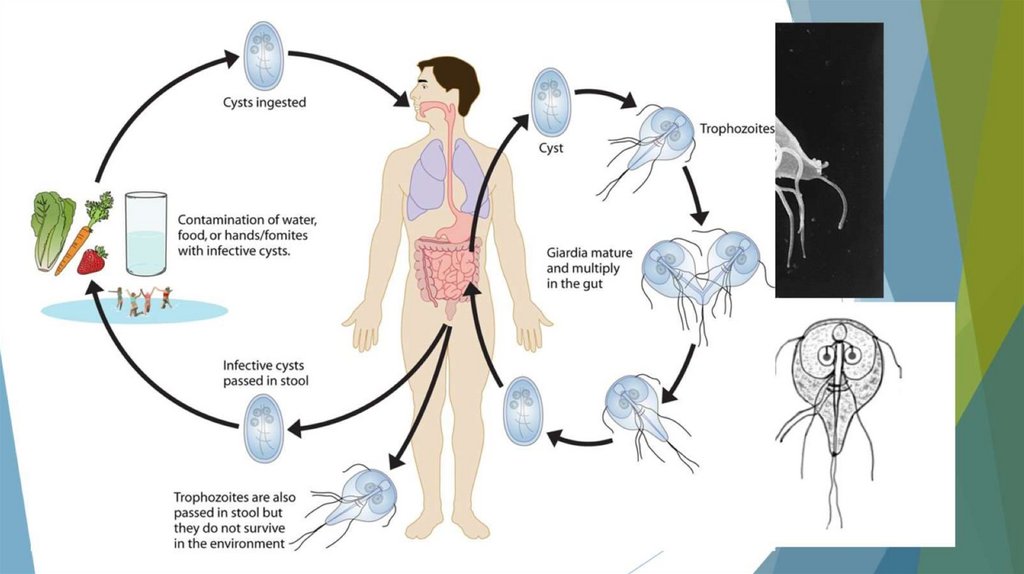 Лямблиоз (гиардиаз)