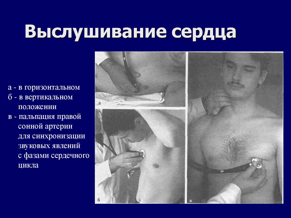 Выслушивание сердца