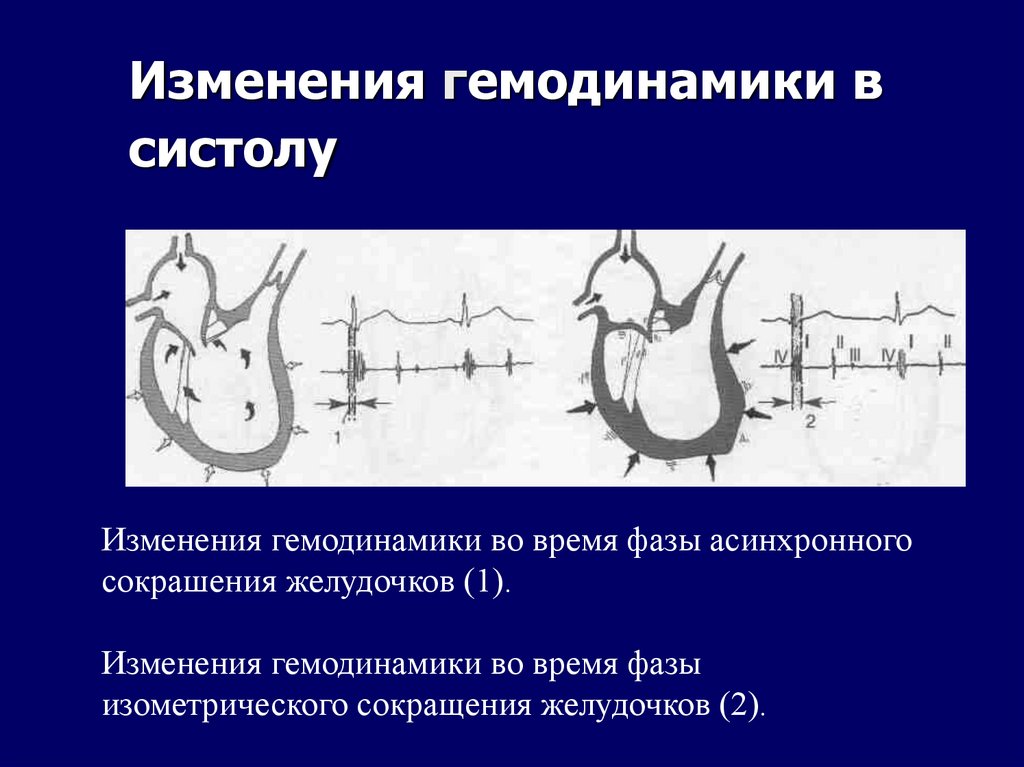 Изменения гемодинамики в систолу