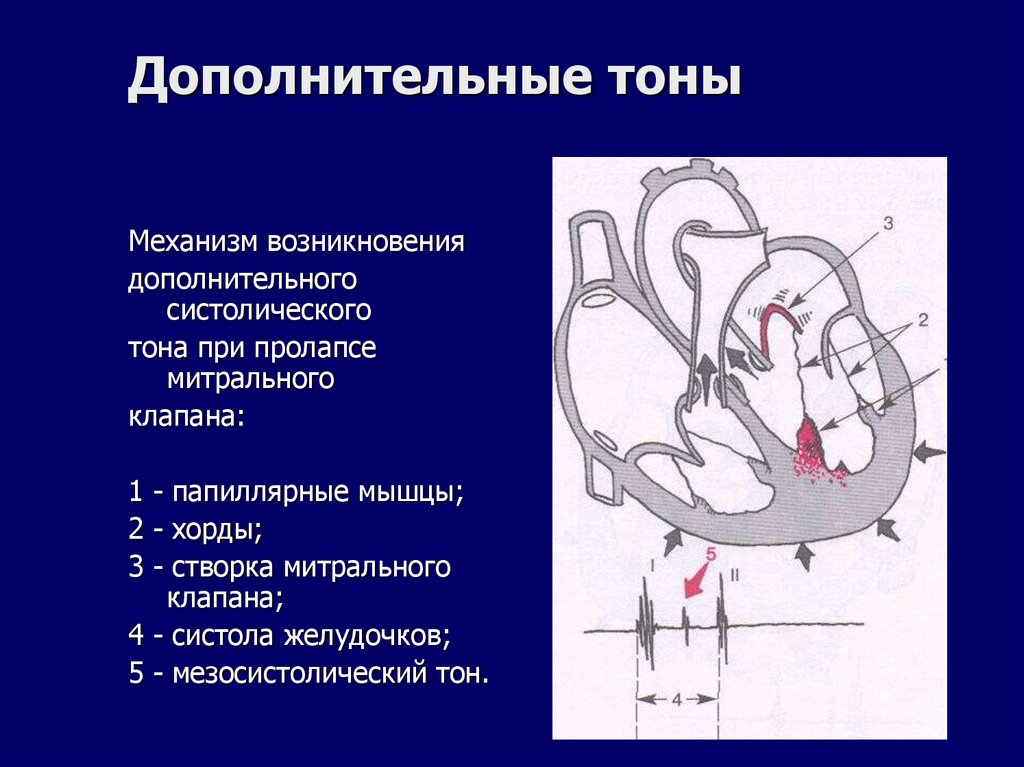 Дополнительные тоны