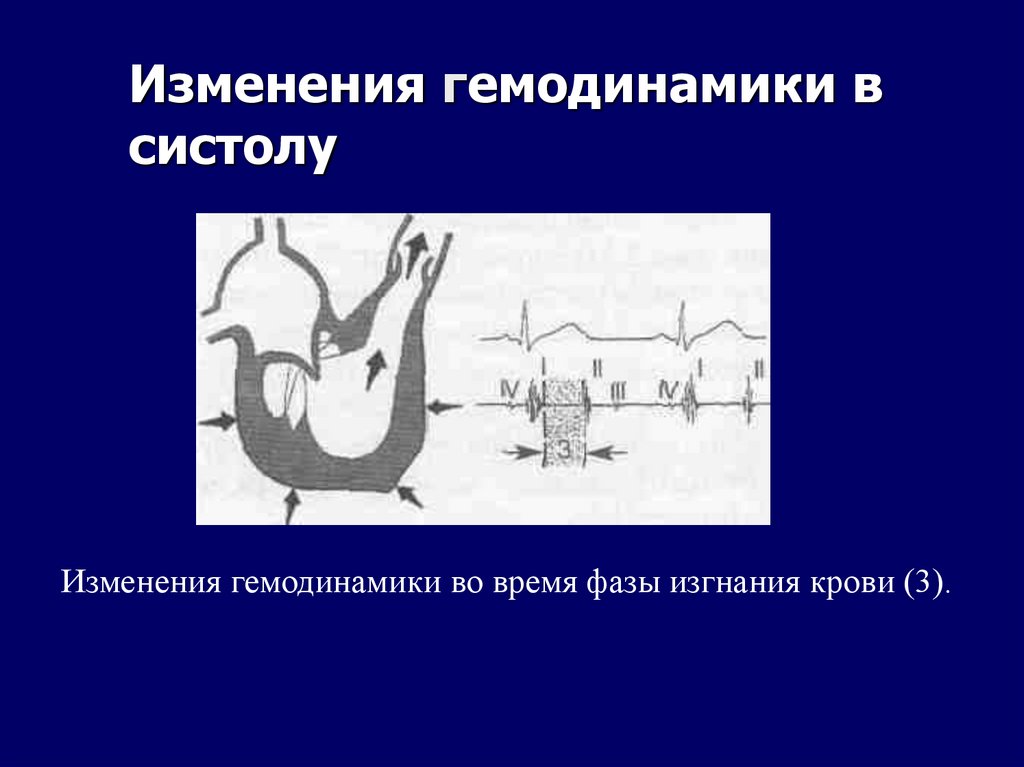 Изменения гемодинамики в систолу