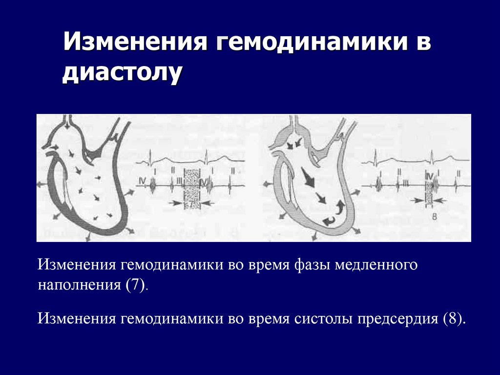 Изменения гемодинамики в диастолу