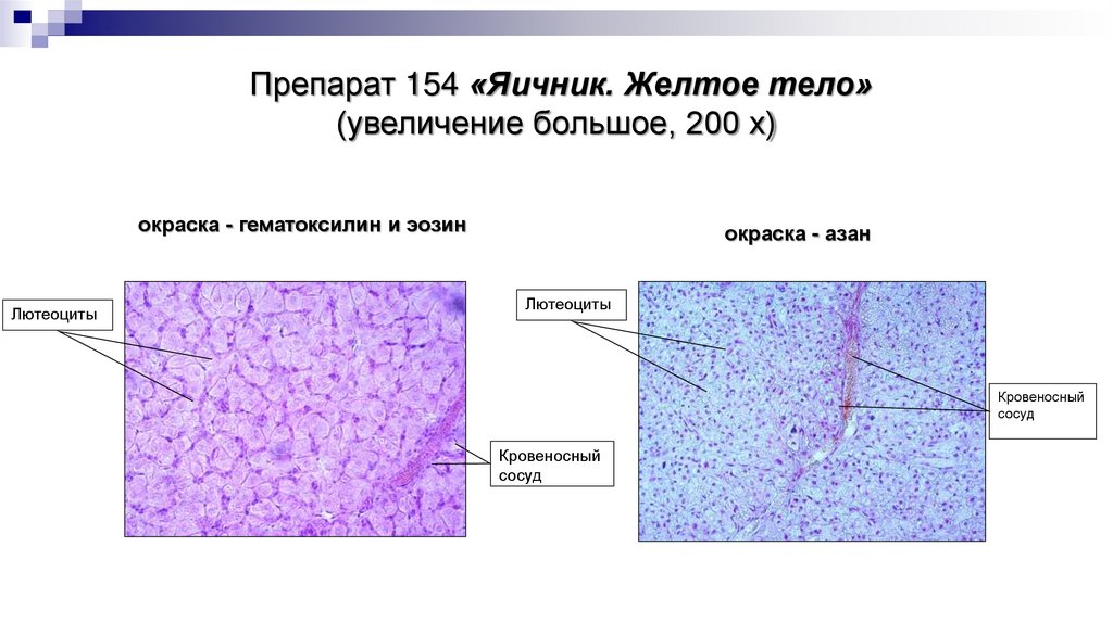 Препарат 154 «Яичник. Желтое тело» (увеличение большое, 200 х)