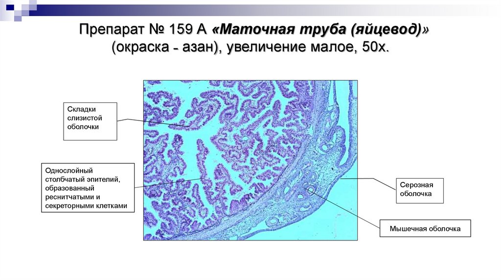 Препарат № 159 А «Маточная труба (яйцевод)» (окраска ˗ азан), увеличение малое, 50х.