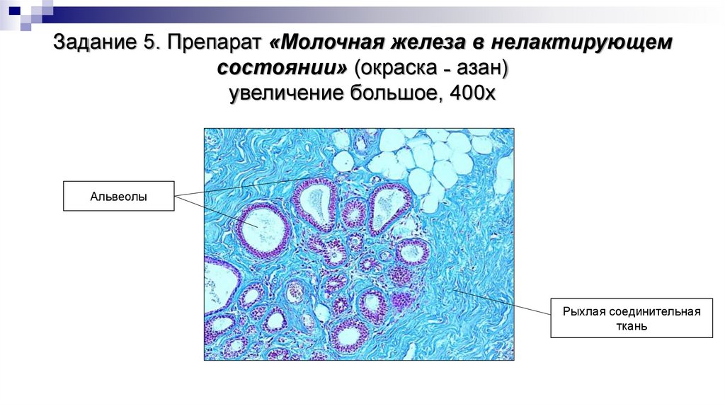 Задание 5. Препарат «Молочная железа в нелактирующем состоянии» (окраска ˗ азан) увеличение большое, 400х