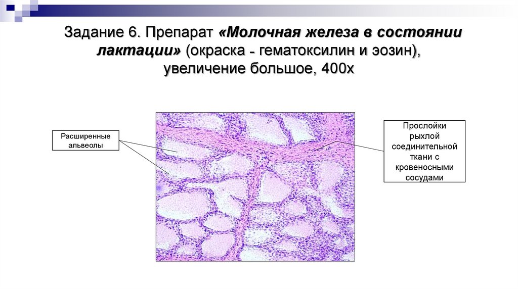 Задание 6. Препарат «Молочная железа в состоянии лактации» (окраска ˗ гематоксилин и эозин), увеличение большое, 400х